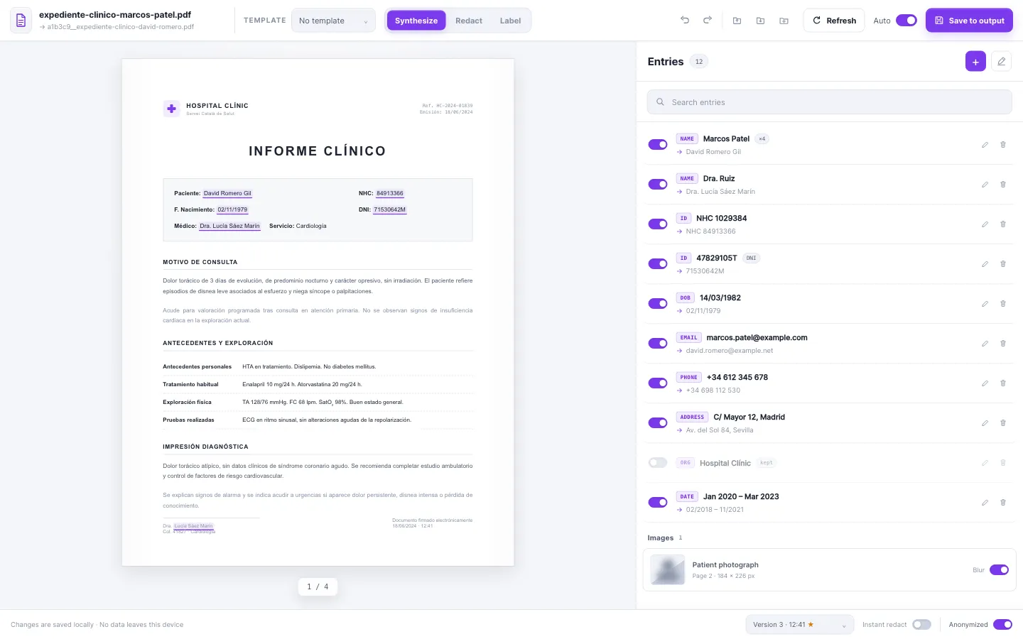 The Anonymization Editor: document on the left, editable entries on the right
